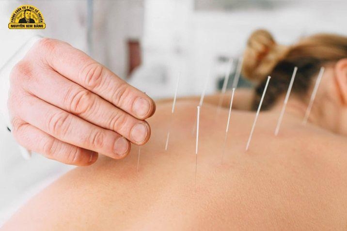 Các phương pháp điều trị bổ trợ không dùng thuốc